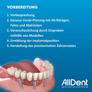 FDZ Infografik Vorbereitung
